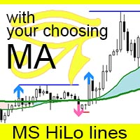 ms-high-low-lines-logo-200x200-6168